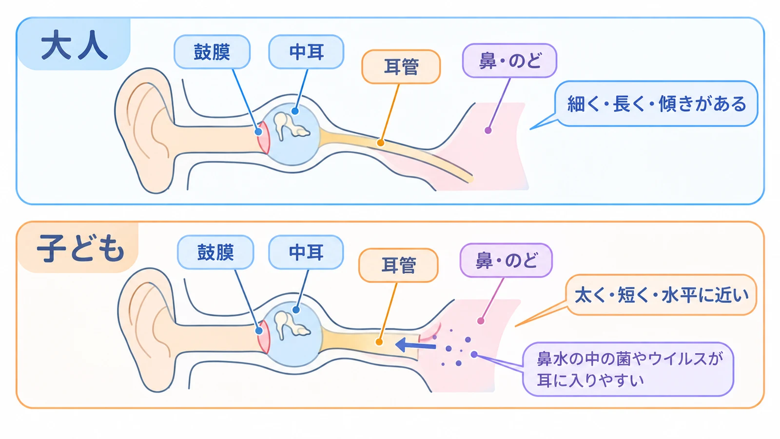 大人と子どもの耳管の比較。大人の耳管は細く・長く・傾きがあり、子どもの耳管は太く・短く・水平に近いため、鼻水の中の菌やウイルスが耳に入りやすい