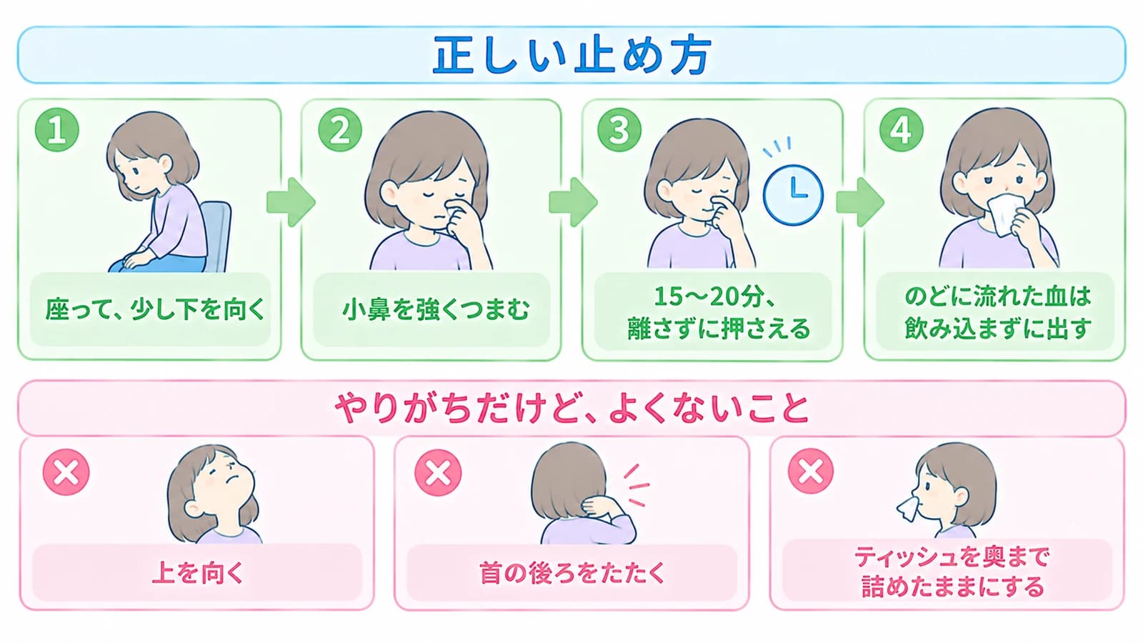 鼻血の正しい止め方4ステップ(座って少し下を向く、小鼻を強くつまむ、15〜20分離さずに押さえる、のどに流れた血は飲み込まずに出す)と、やりがちだけどよくないこと(上を向く、首の後ろをたたく、ティッシュを奥まで詰めたままにする)