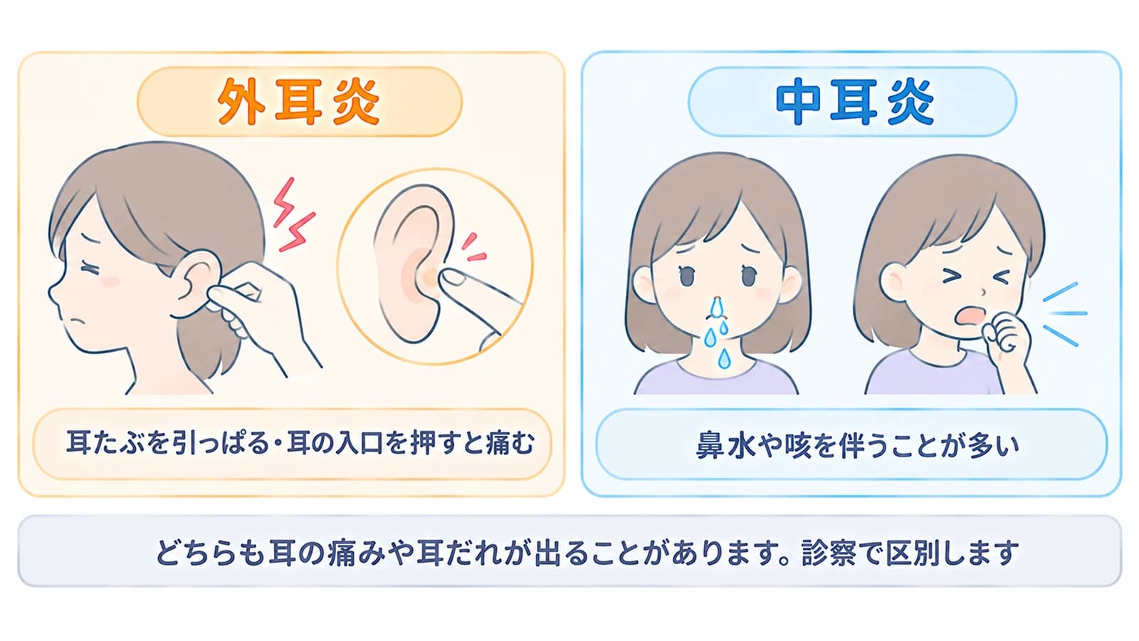 外耳炎と中耳炎の見分け方。外耳炎は耳たぶを引っぱったり耳の入口を押したりすると痛む。中耳炎は鼻水や咳を伴うことが多い。どちらも耳の痛みや耳だれが出ることがあり、診察で区別する