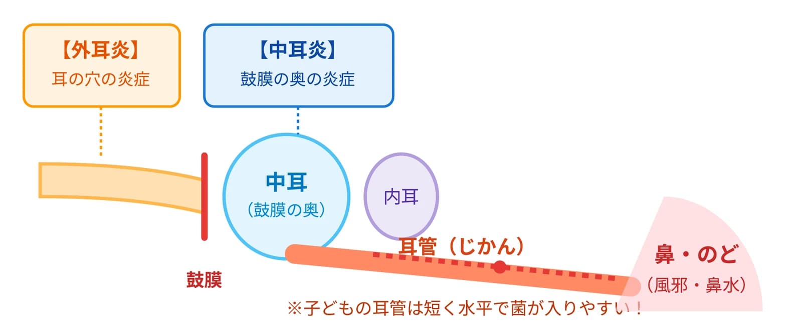 耳の断面の図。外耳炎は耳の穴の炎症、中耳炎は鼓膜の奥の炎症。子どもの耳管は短く水平で、鼻・のどから菌が入りやすい